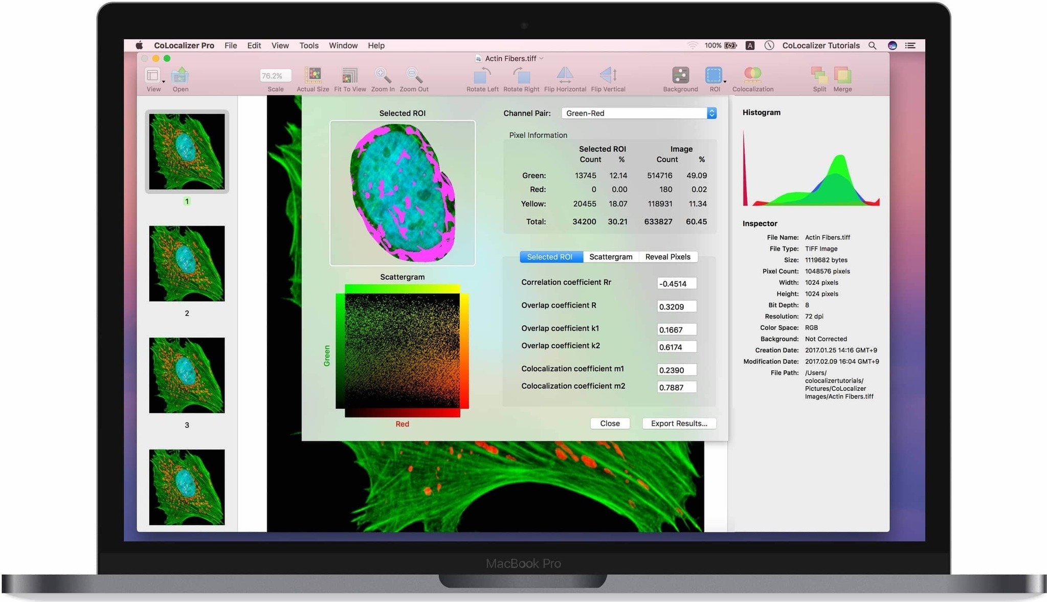 CoLocalizer Pro 7.0.2 (982) 定量共定位分析软件