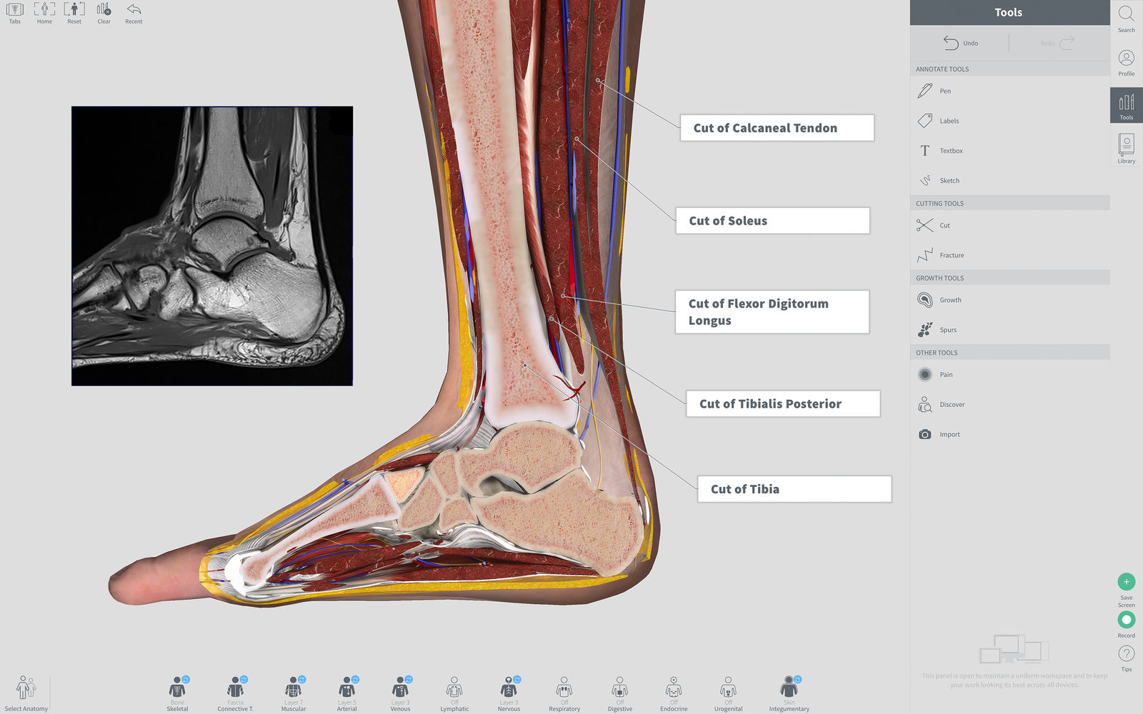 Complete Anatomy 2019 4.0.1 3D人体解剖结构学习软件