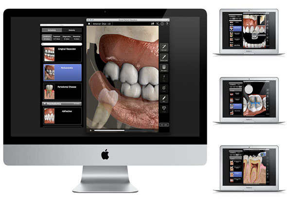 Dental Patient Education 1.1 for Mac|Mac版下载 | 